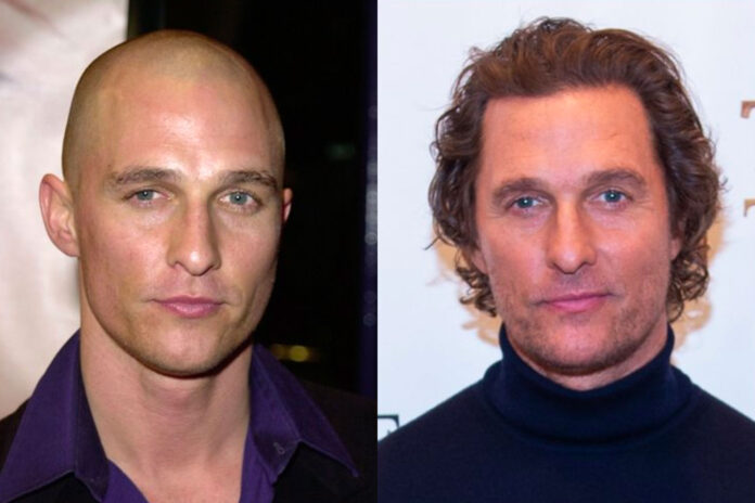 Matthew McConaughey trapianto capelli Matthew McConaughey trapianto capelli