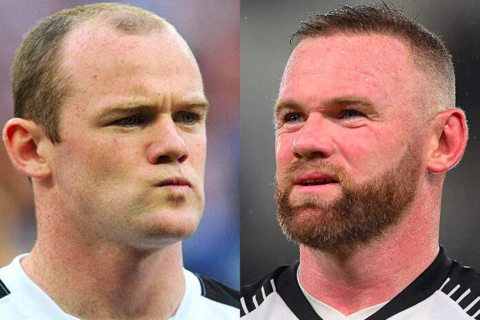 Wayne Rooney trapianto capelli