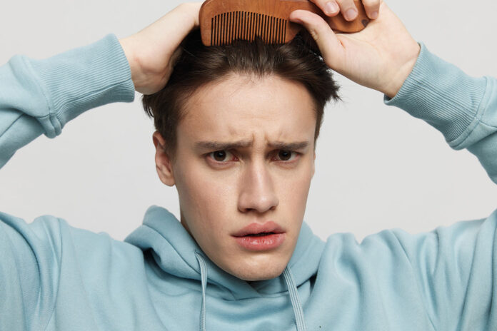 calvizie nei giovani cause e rimedi