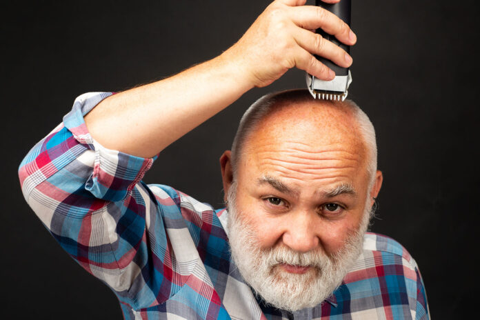 cause della calvizie