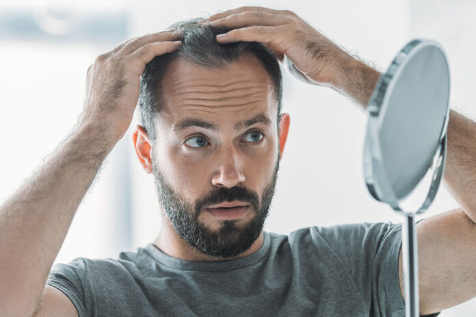 perdita dei capelli immagine di se