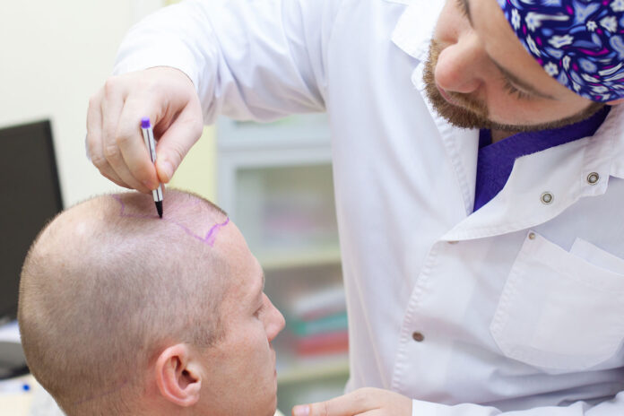 preparazione al trapianto