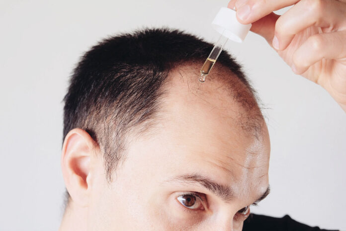 prodotti caduta dei capelli uomo prodotti caduta dei capelli uomo