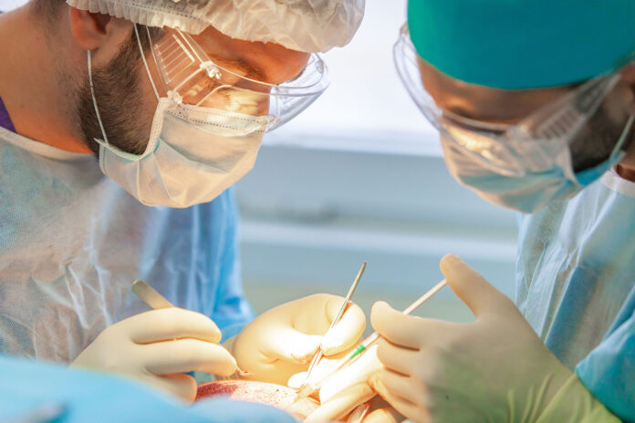 come scegliere la clinica per il trapianto di capelli