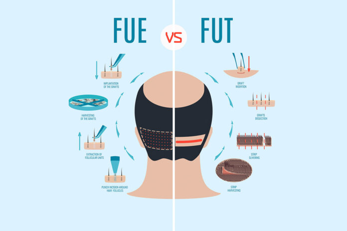 tecnica mista fue e fut