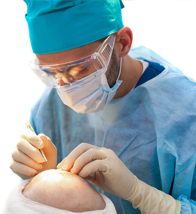 trapianto-capelli-home