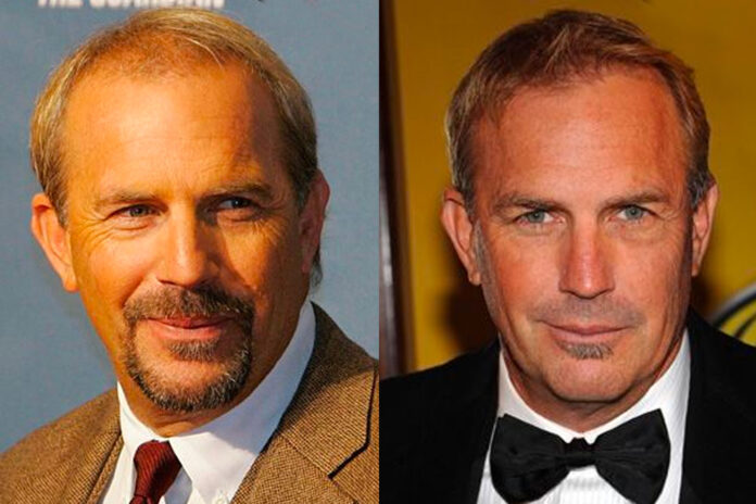 trapianto capelli kevin costner