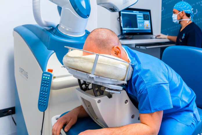 trapianto capelli robotizzato