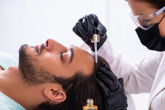 trattamenti perdita capelli