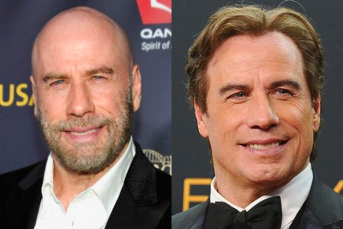 john travolta trapianto capelli