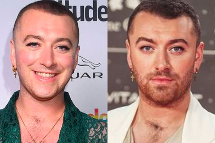 sam smith trapianto capelli sam smith trapianto capelli